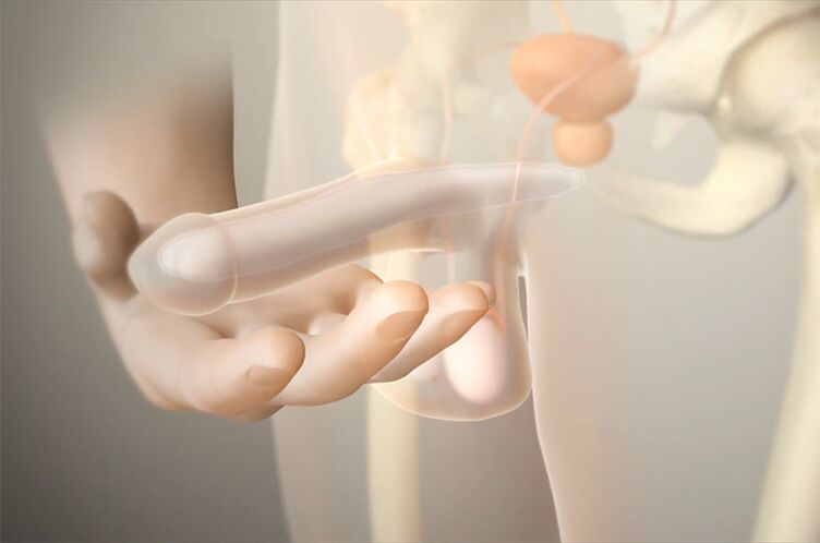 Gel implants to increase member