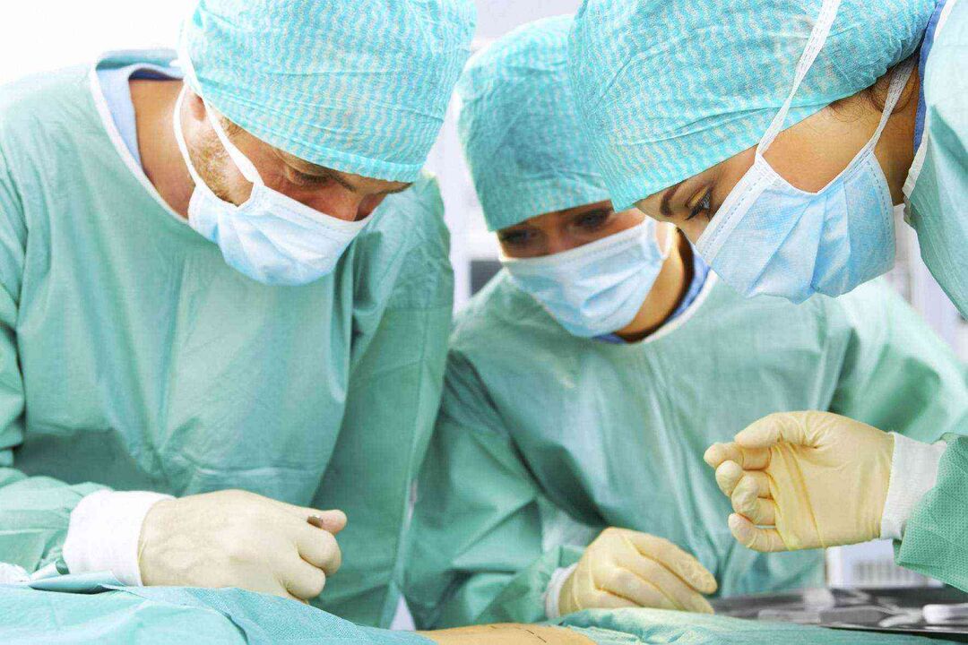 Penis enlargement surgery and its price photos 3
