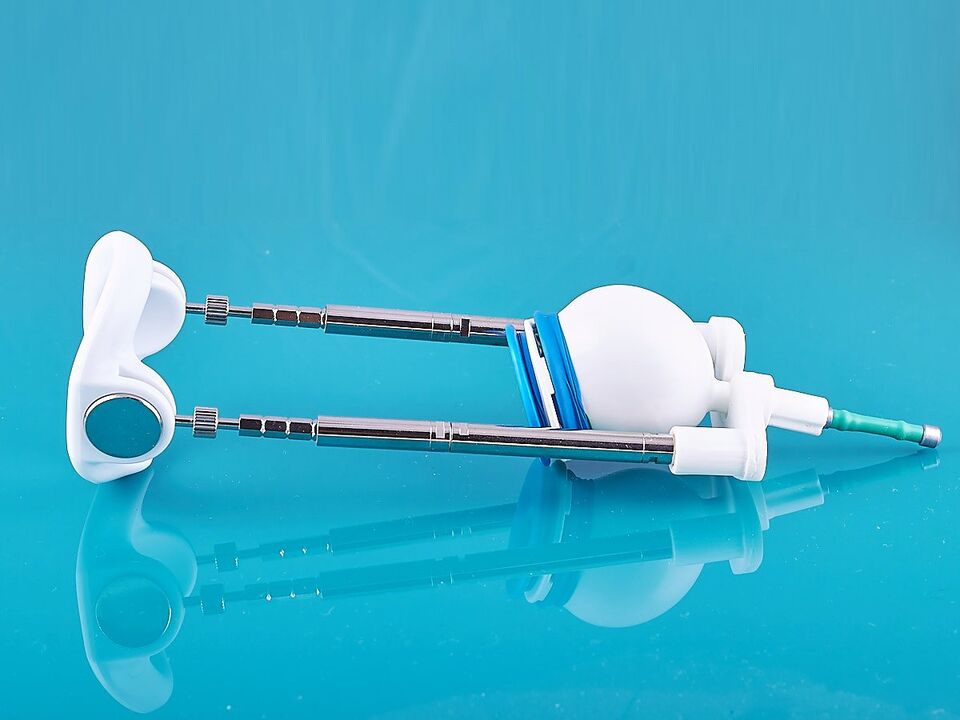 The extender will help improve the results of the ligamentotomy