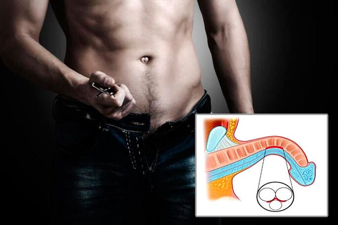 Man don't separate his fly for exercises to expand penis