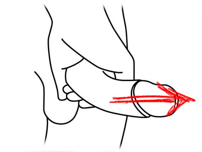 Stretching the penis to expand